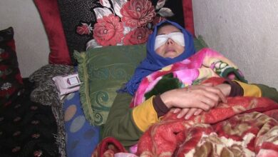 صورة لأسباب عاطفية شاب يفقع عيون عشيقته “صورة وتفاصيل”