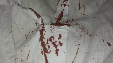 صورة وفاة شاب بشكل مأساوي في مدينة كوبني “تفاصيل الحادثة “