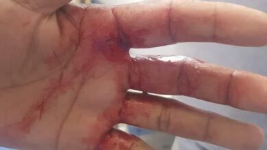 صورة عملية طعن في سوق “كبيتال ” قبل قليل “تفاصيل”
