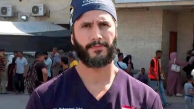 صورة في عملية معقدة جراح يعيد ذراع طفلة بعد بتره في الحرب